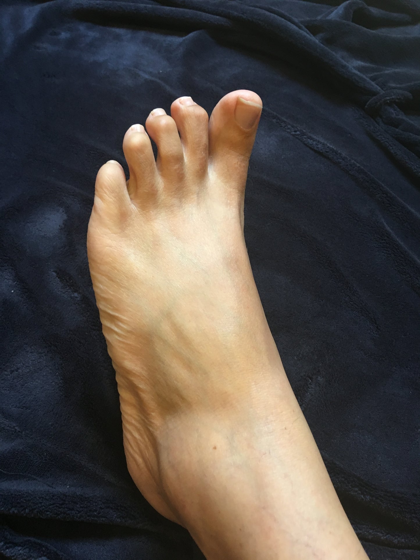 Goodnight Cramp Pouch, foot cramp relief, foot with cramp
